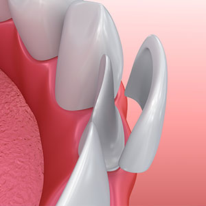 Family Dentist in Greenville SC